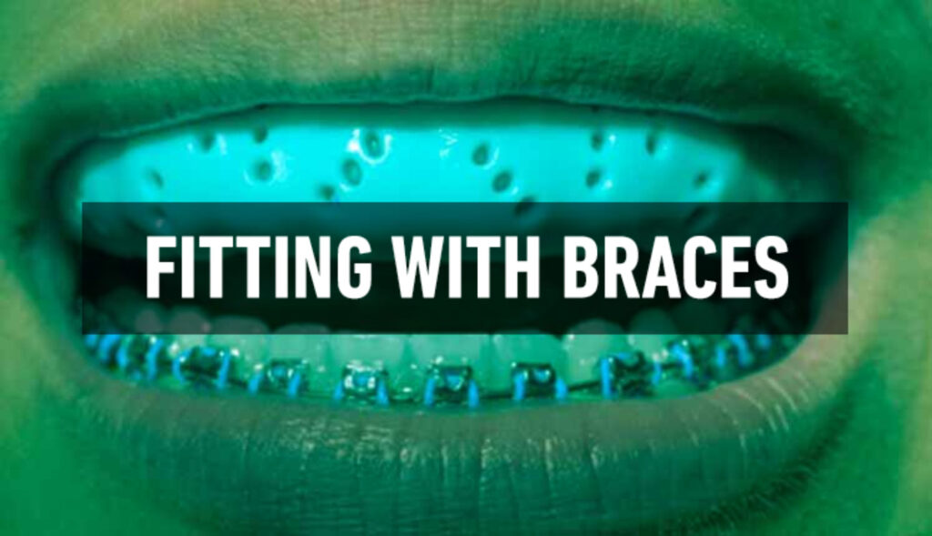 Click here for Fitting with braces guide